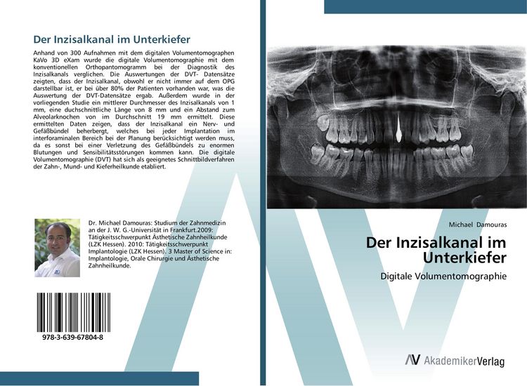 Produktbild: Der Inzisalkanal im Unterkiefer