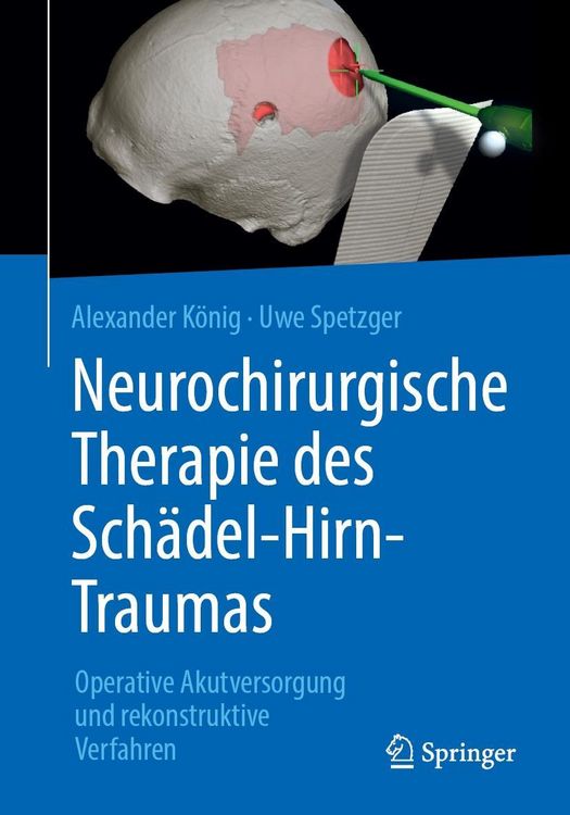 Produktbild: Neurochirurgische Therapie des Sch&auml;del-Hirn-Traumas