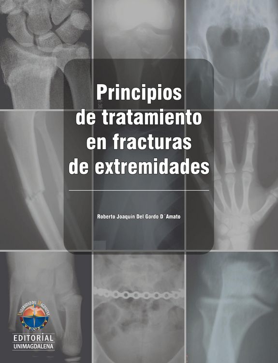 Produktbild: Principios de tratamiento en fracturas de extremidades