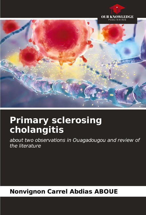 Produktbild: Primary sclerosing cholangitis