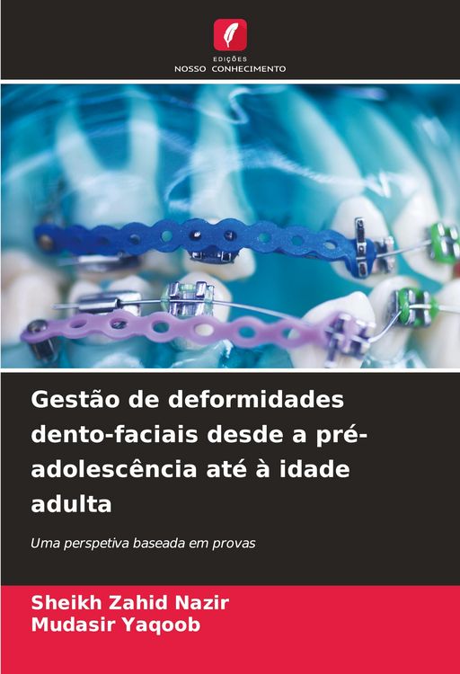 Produktbild: Gest&atilde;o de deformidades dento-faciais desde a pr&eacute;-adolesc&ecirc;ncia at&eacute; &agrave; idade adulta