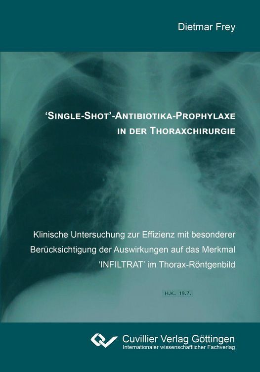Produktbild: 'Single-Shot'-Antibiotika-Prophylaxe in der Thoraxchirurgie