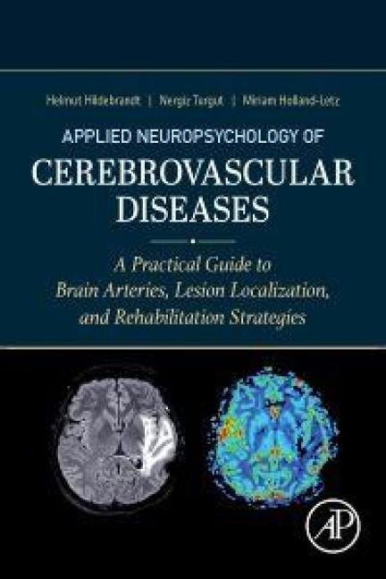 Produktbild: Applied Neuropsychology of Cerebrovascular Diseases