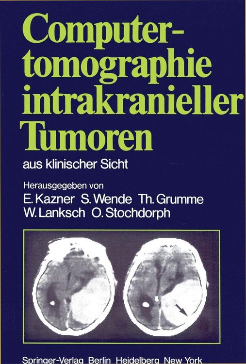 Produktbild: Computertomographie intrakranieller Tumoren aus klinischer Sicht