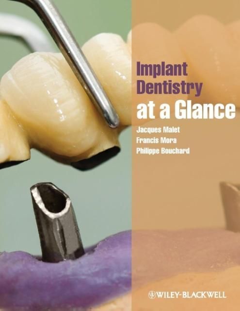 Produktbild: Implant Dentistry at a Glance