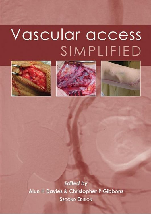 Produktbild: Vascular Access Simplified; second edition
