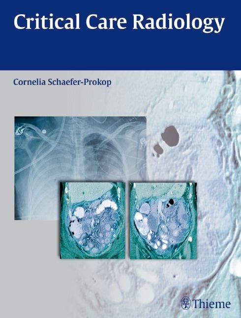 Produktbild: Critical Care Radiology