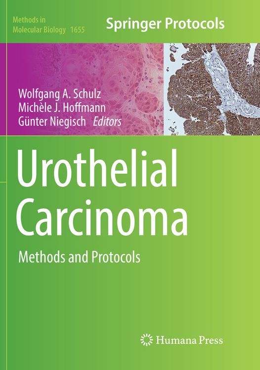 Produktbild: Urothelial Carcinoma