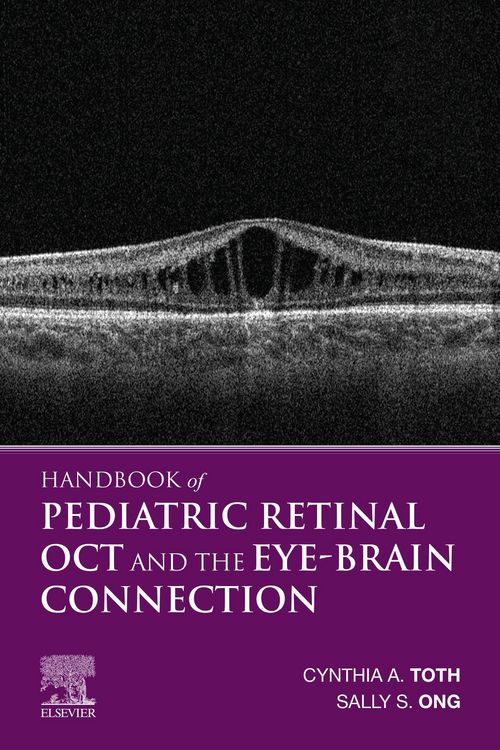 Produktbild: Handbook of Pediatric Retinal OCT and the Eye-Brain Connection E-Book