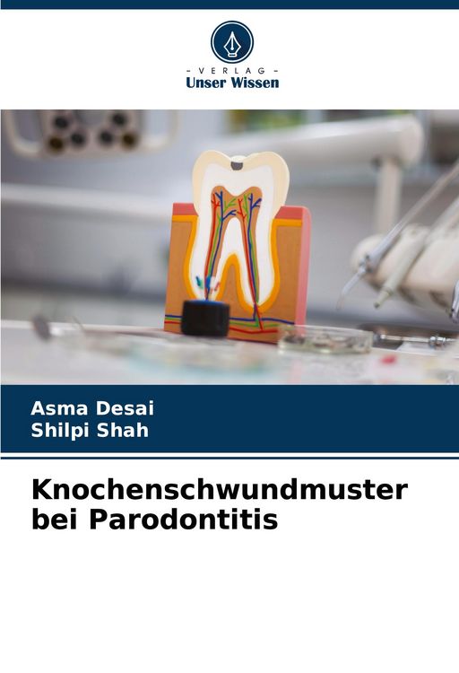 Produktbild: Knochenschwundmuster bei Parodontitis