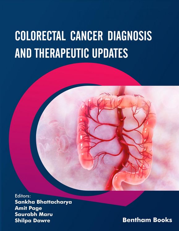 Produktbild: Colorectal Cancer Diagnosis and Therapeutic Updates