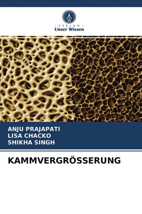 Produktbild: Kammvergr&ouml;sserung