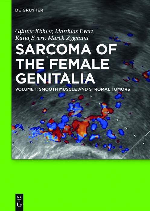 Produktbild: Smooth muscle and stromal tumors and prevention of inadequate surgery