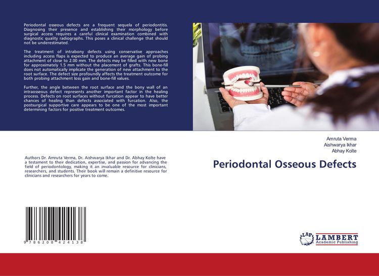 Produktbild: Periodontal Osseous Defects