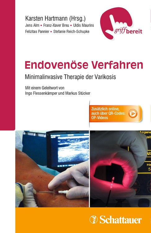 Produktbild: Endoven&ouml;se Verfahren