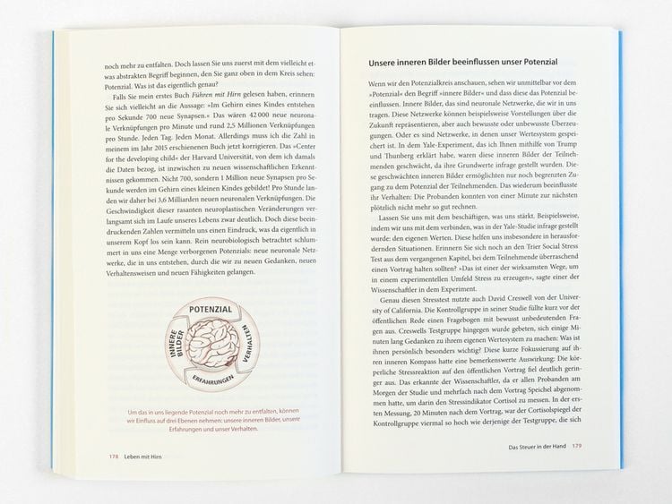 Produktbild: Leben mit Hirn