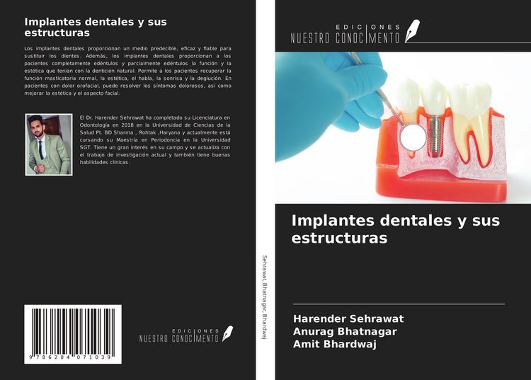 Produktbild: Implantes dentales y sus estructuras