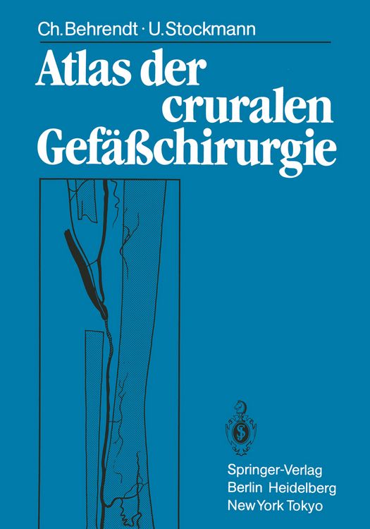 Produktbild: Atlas der cruralen Gef&auml;&szlig;chirurgie