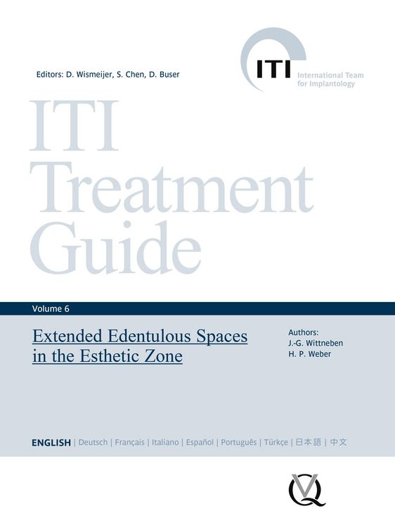 Produktbild: Extended Edentulous Spaces in the Esthetic Zone