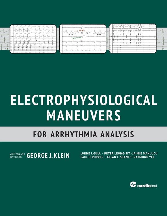 Produktbild: Electrophysiological Maneuvers for Arrhythmia Analysis
