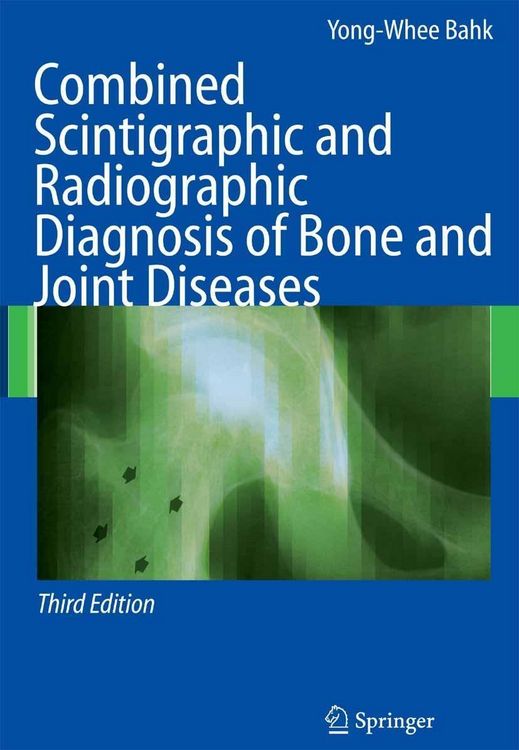 Produktbild: Combined Scintigraphic and Radiographic Diagnosis of Bone and Joint Diseases