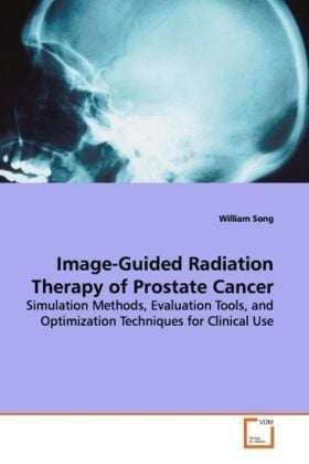 Produktbild: Song, W: Image-Guided Radiation Therapy of Prostate Cancer