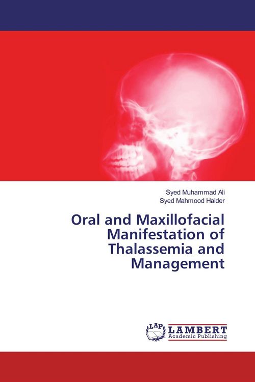 Produktbild: Oral and Maxillofacial Manifestation of Thalassemia and Management