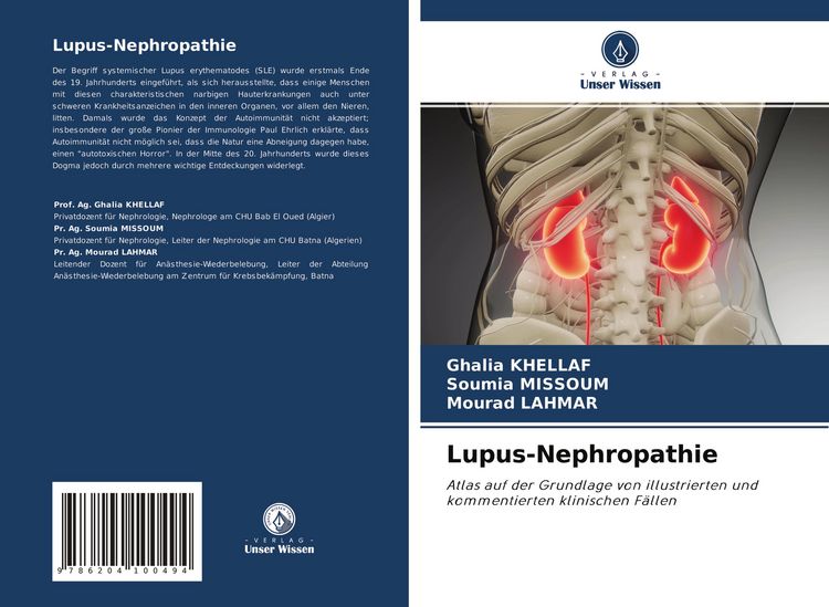 Produktbild: Lupus-Nephropathie