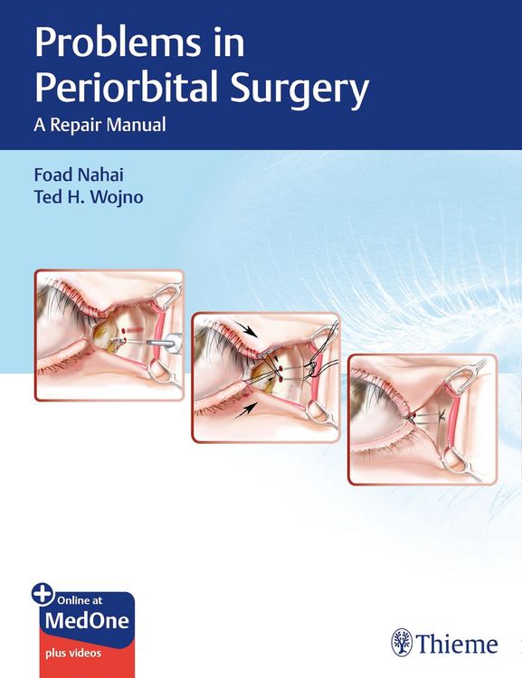 Produktbild: Problems in Periorbital Surgery