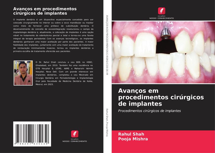 Produktbild: Avan&ccedil;os em procedimentos cir&uacute;rgicos de implantes