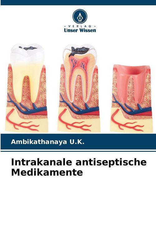 Produktbild: Intrakanale antiseptische Medikamente
