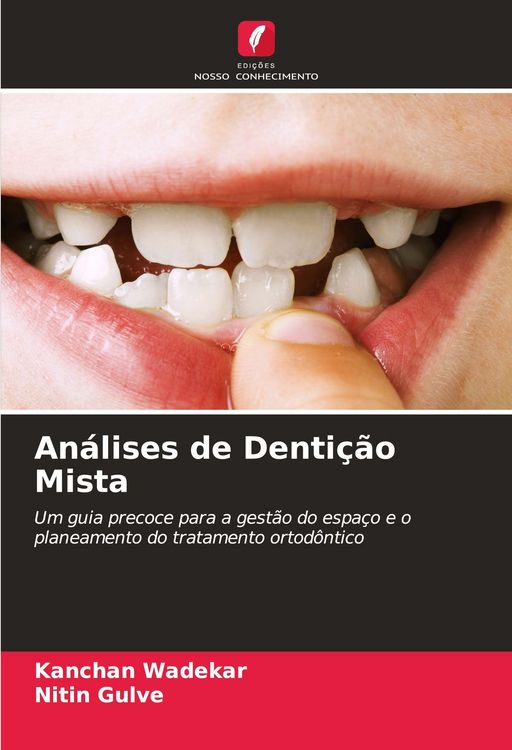 Produktbild: An&aacute;lises de Denti&ccedil;&atilde;o Mista
