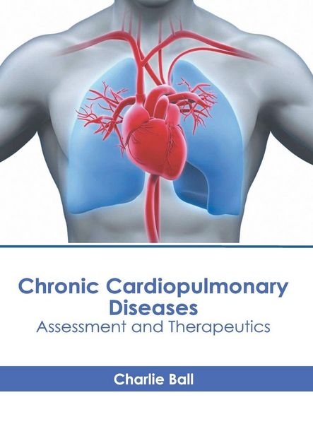 Produktbild: Chronic Cardiopulmonary Diseases: Assessment and Therapeutics