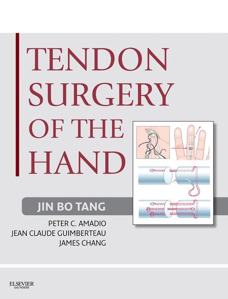 Produktbild: Tendon Surgery of the Hand E-Book