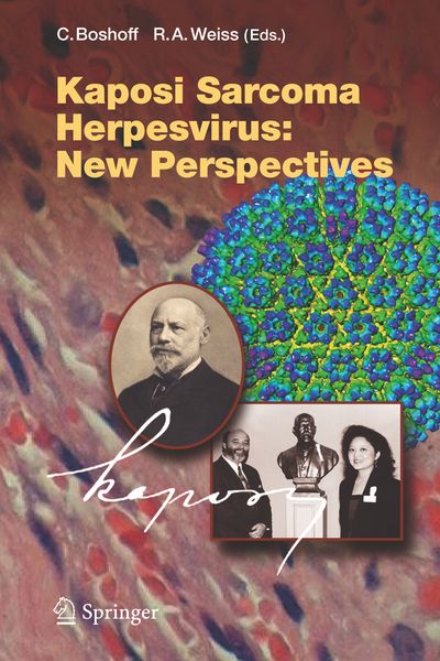 Produktbild: Kaposi Sarcoma Herpesvirus: New Perspectives