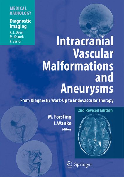 Produktbild: Intracranial Vascular Malformations and Aneurysms