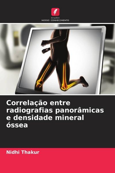 Produktbild: Correla&ccedil;&atilde;o entre radiografias panor&acirc;micas e densidade mineral &oacute;ssea