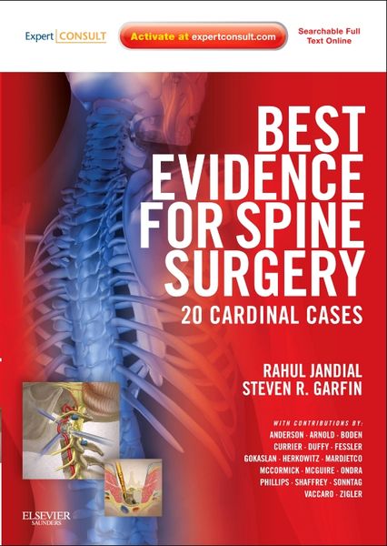 Produktbild: Best Evidence for Spine Surgery