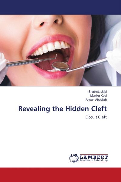 Produktbild: Revealing the Hidden Cleft