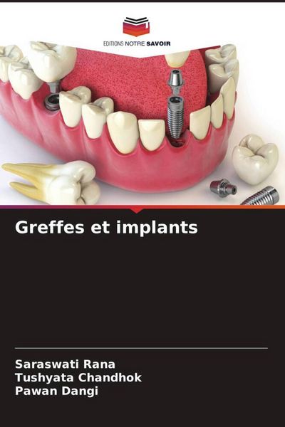Produktbild: Greffes et implants