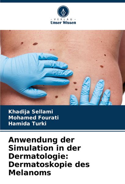 Produktbild: Anwendung der Simulation in der Dermatologie: Dermatoskopie des Melanoms