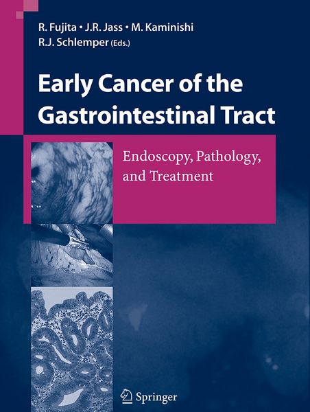 Produktbild: Early Cancer of the Gastrointestinal Tract