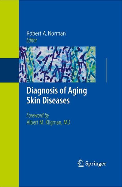 Produktbild: Diagnosis of Aging Skin Diseases