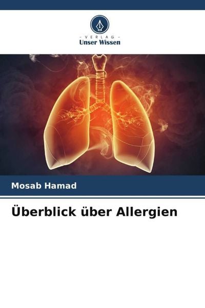 Überblick über Allergien, Taschenbuch von Mosab Hamad, Verlag Unser Wissen, 9786205297315