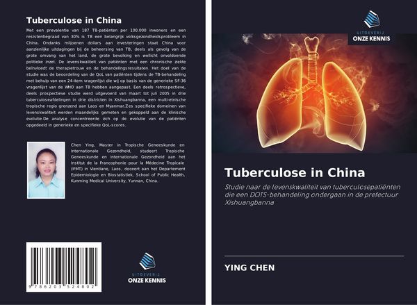 Produktbild: Tuberculose in China