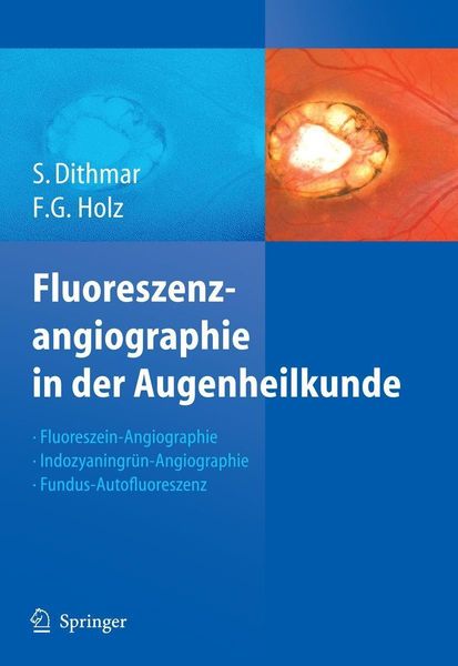 Produktbild: Fluoreszenzangiographie in der Augenheilkunde