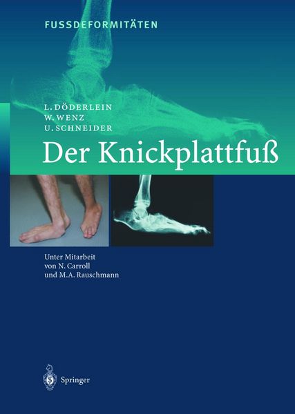 Produktbild: Fussdeformit&Auml;ten