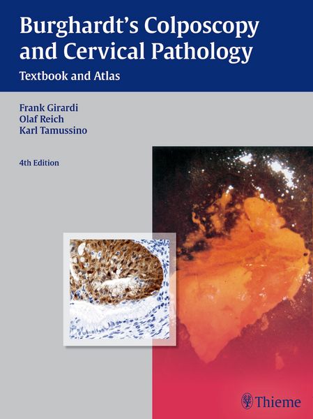 Produktbild: Burghardt's Colposcopy and Cervical Pathology