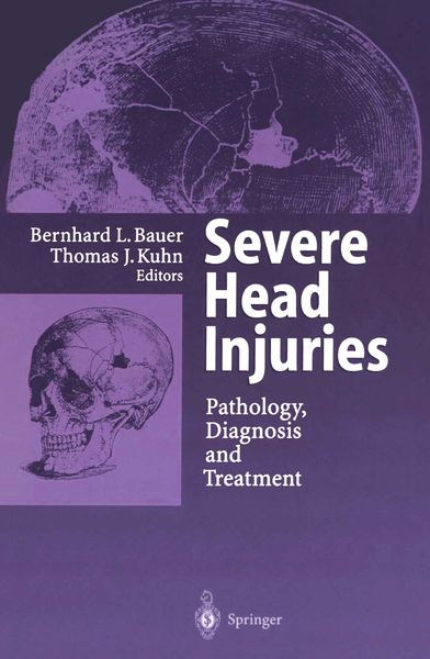 Produktbild: Severe Head Injuries
