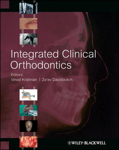 Produktbild: Integrated Clinical Orthodontics